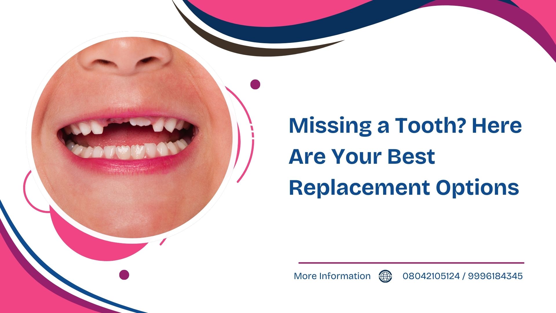 Missing a Tooth? Here Are Your Best Replacement Options